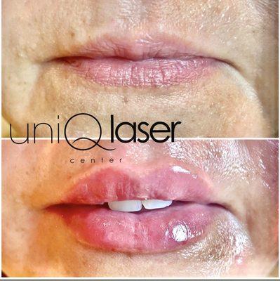 UniQ Laser Center