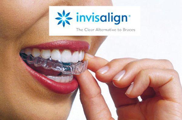 We do Invisalign! Call now for a consultation!!