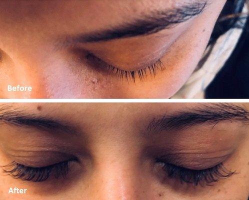 Eyelash Extensions