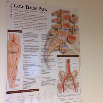 Low back pain poster in the waiting room.