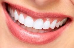 Our emax veneers