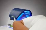 Celluma LED Treatment for Acne