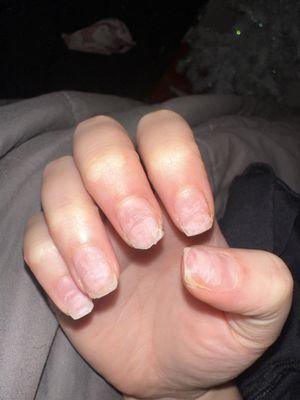 my nails after