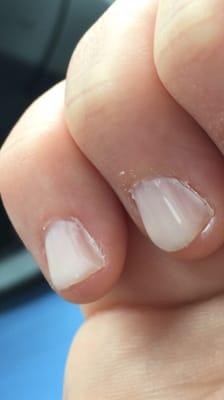 gel over cuticles