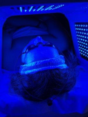 Blue LED light therapy