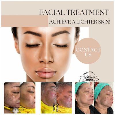 Facial