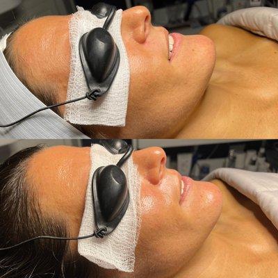 Brightening and Hydrating Facial