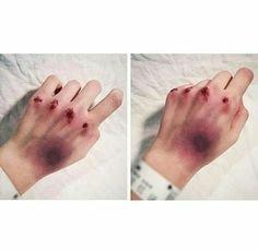 My hands after two lessons, really cool