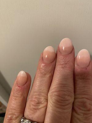 Terrible ombre dip nails. He filed down my real nails against my wish, crooked and uneven length. Sliced my skin with a file 3 times