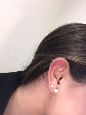 Cartilage (3 years ago)