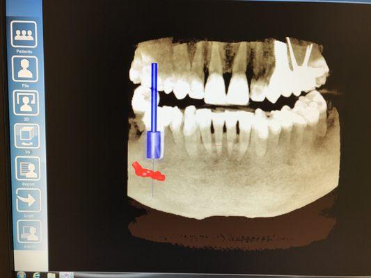 Saryan Dental