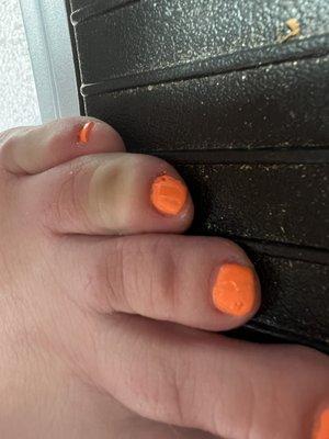 Toe