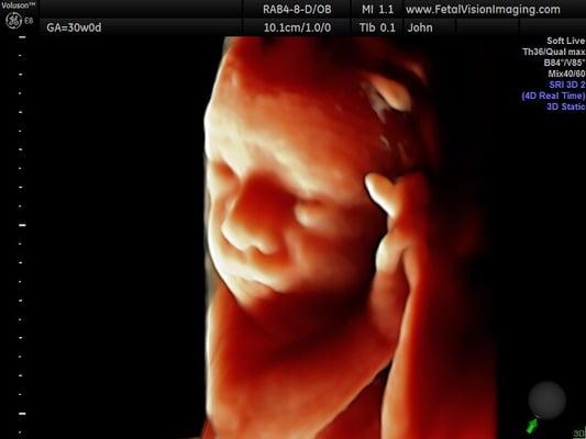 Amazing and beautiful image of our soon to be born babe at 30 weeks! Thank you Fetal Vision!!!