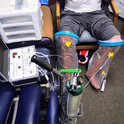 Medical Ozone Therapy: Limb Bagging