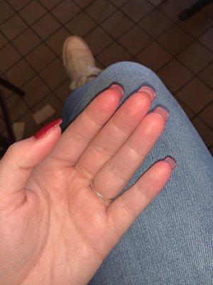 Stained fingers that weren't cleaned