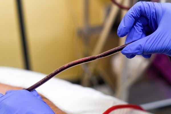 Debris coming out of a Long COVID patient's blood.