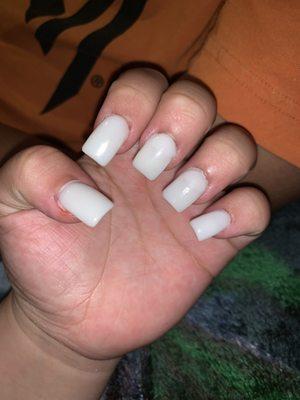 Horrible nails