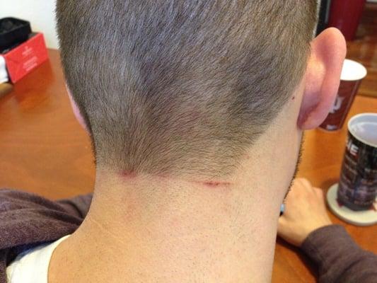 This is from 3 days ago. Most painful haircut I've ever had. Great shop but this can't happen.