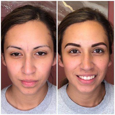 Before and immediately after procedure