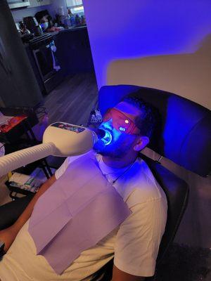 Teeth Whitening Session