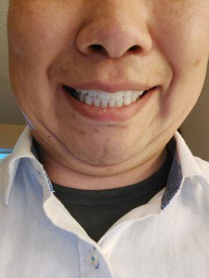 Thanks to the care of my dentist, I have a brilliant smile.