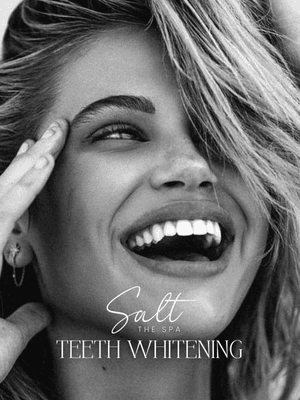 Did you know we offer TEETH WHITENING?! Quickly brighten you smile & boost your confidence with our teeth whitening service!