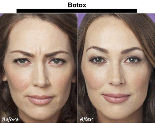 Defy aging and age gracefully with Botox and Collagen Fillers. Complimentary Consultations are always available...