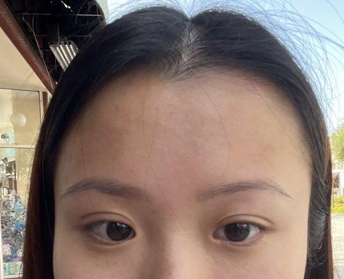 Uneven eyebrows.