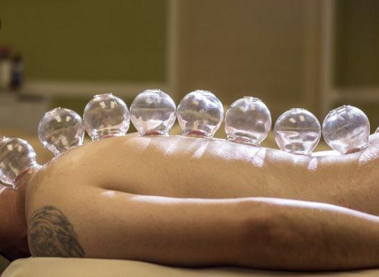 Cupping