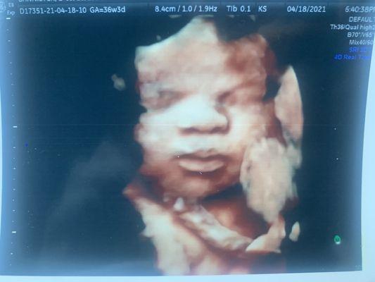 Mommy's whole face!