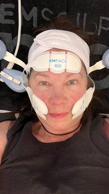 Emsculpt electronic lifting!