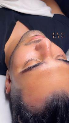 Treat your man to Deluxe Hydrafacial