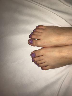 horrible pedicure