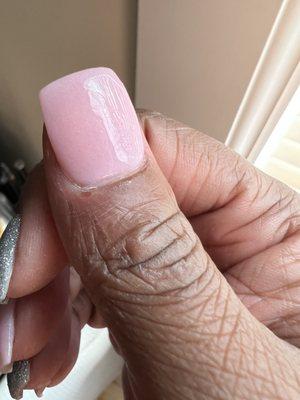 Busted up cuticle and terrible shaping