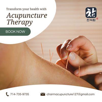 Charm Acupuncture