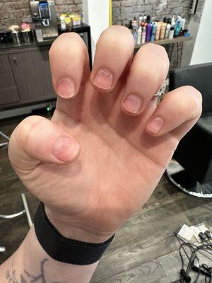 Drilled down nails