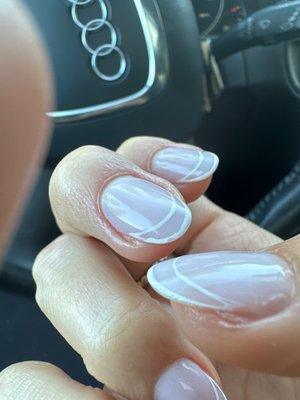 Missing patches and too small acrylic nail