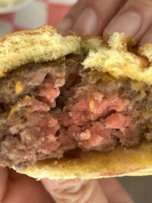 This is an example of one of one of the burgers. This one was the least uncooked. Again we asked for the burgers to be well done.