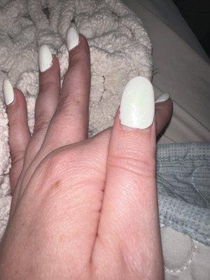 The thumb nail that was done today and looks grown out.