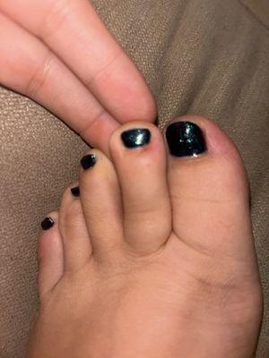 My toe, cut from a pedicure I got.