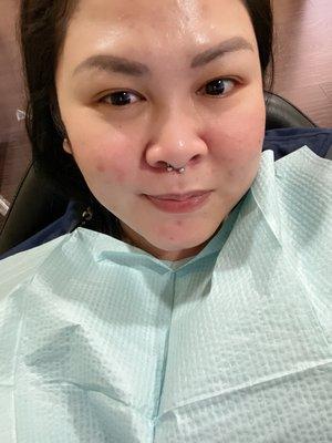 Endodontist Appointment