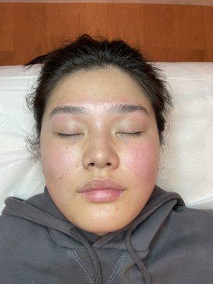 Brow shaping