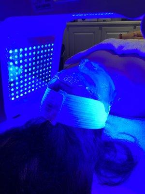 LED Light Therapy + Hydrojelly Mask for acne prone skin