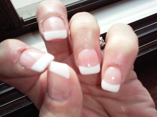 These are the nails I previously just wrote about,  the one the owner couldn't see anything wrong with on the cuticles.