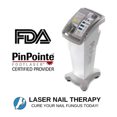 Heal your toenail fungus. Laser nail therapy.