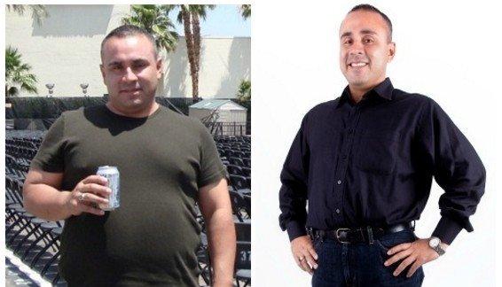 Before and after with medically supervised weight loss