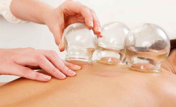 Experience professional cupping therapy to relieve muscle tension, improve circulation, and enhance overall well-being.