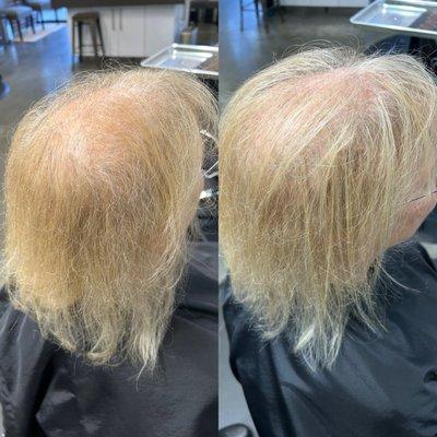 Before and after Combline Extensions. Add density and volume to thinning hair. Starting at $150.