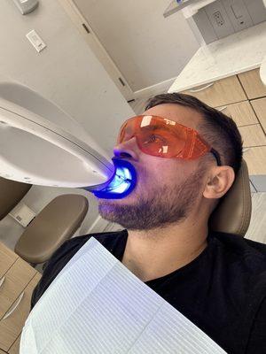 Teeth Whitening