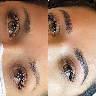 Brow correction